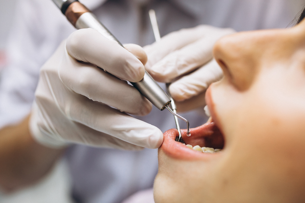 Zdravotné poisťovne lákajú na príspevky na zuby či okuliare, no na ich získanie treba splniť prísne podmienky